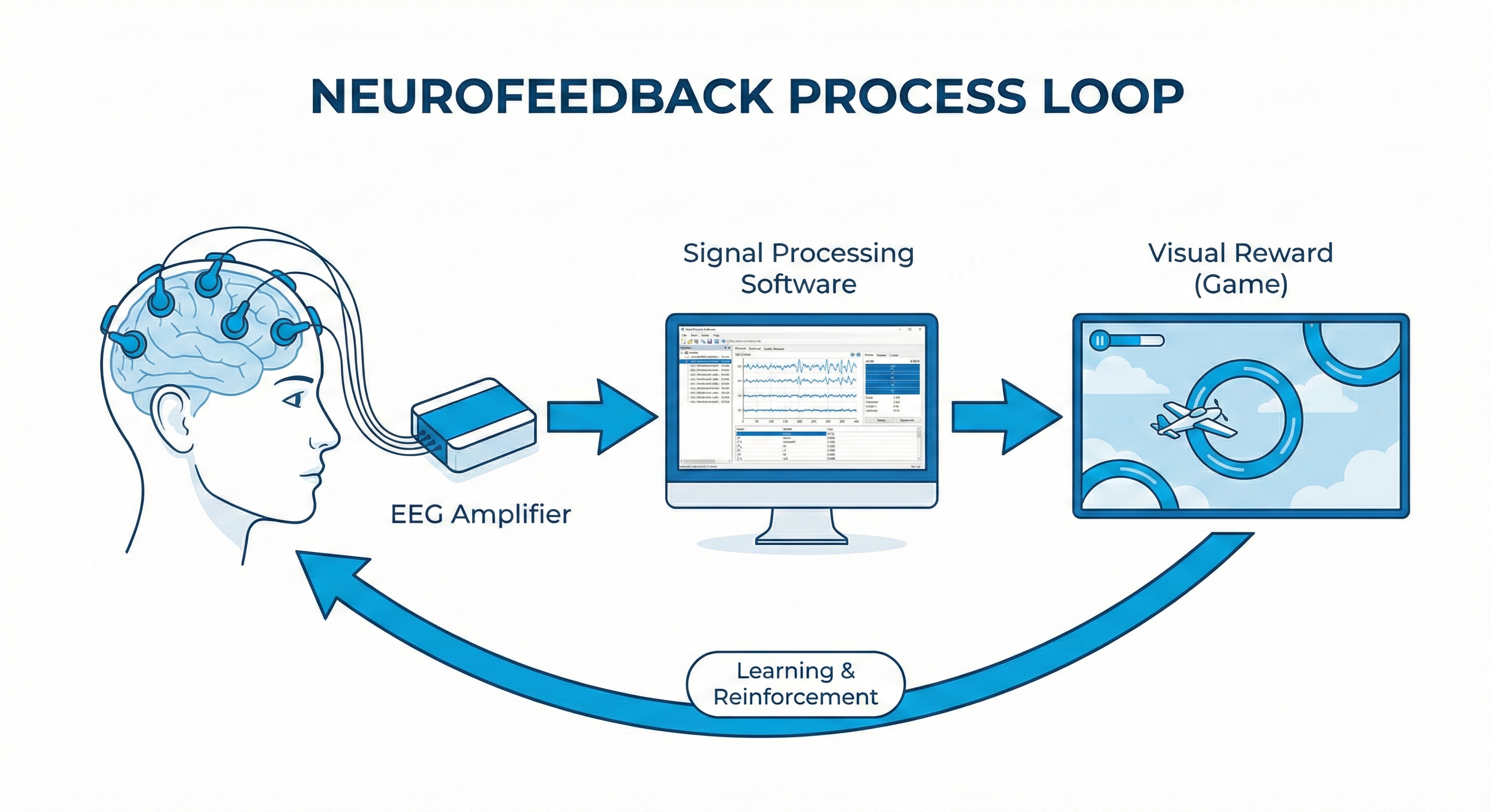 Neurofeedback Feedback Loop Diagram